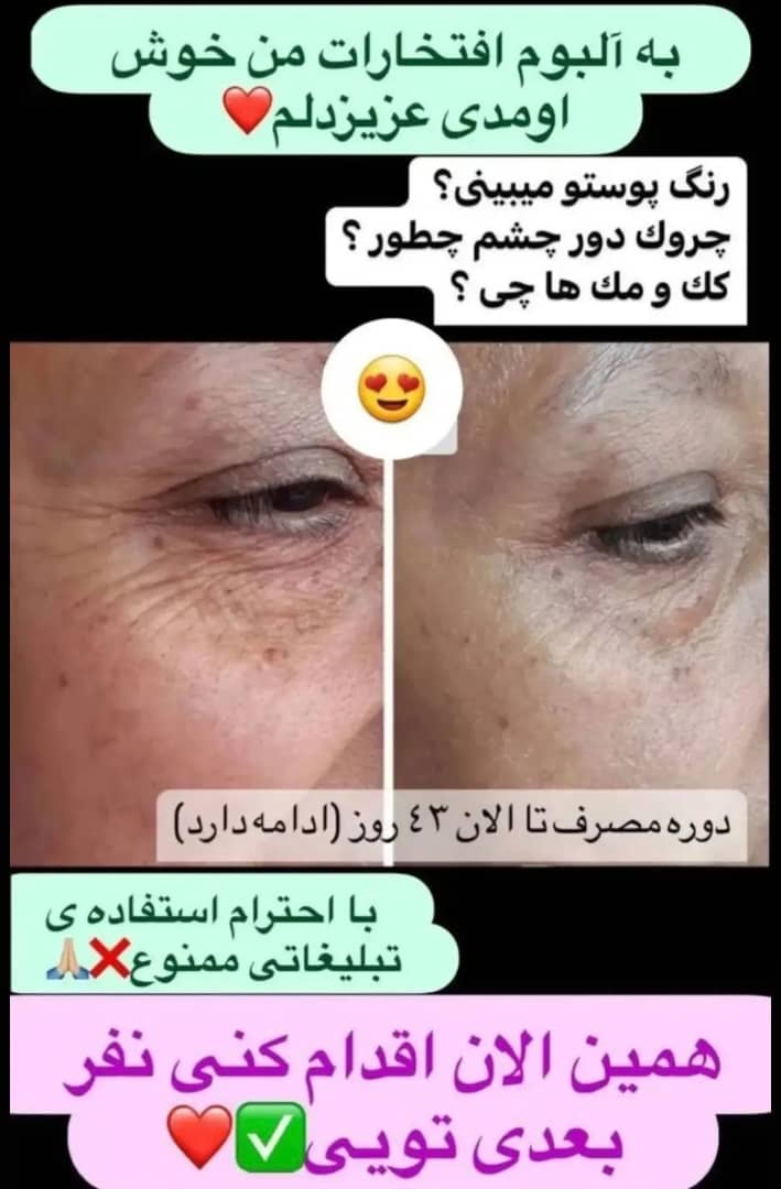 کرم ضدچروک گاتیو با فرمول حرفه‌ای برای جوان‌سازی