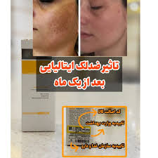 کرم گاتیو ویتامین سی با بافت سبک و جذب بالا 😍💫»