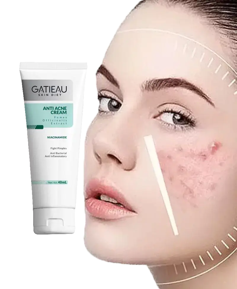 ژل ضدجوش گاتیو برای پوست حساس و انواع پوست مشاوره رایگان