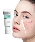 ژل ضدجوش گاتیو برای پوست حساس و انواع پوست مشاوره رایگان