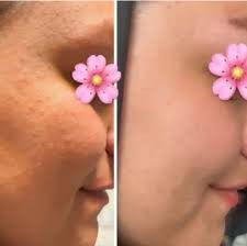 سرم مغذی لاکچری کوین برای تغذیه عمیق و آبرسانی پوست صورت