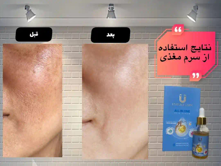 قبل وبعداستفاده ازمحصول