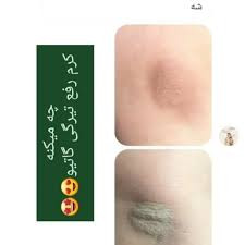 نتیجه استفاده از کرم روشنکننده بدن gatio